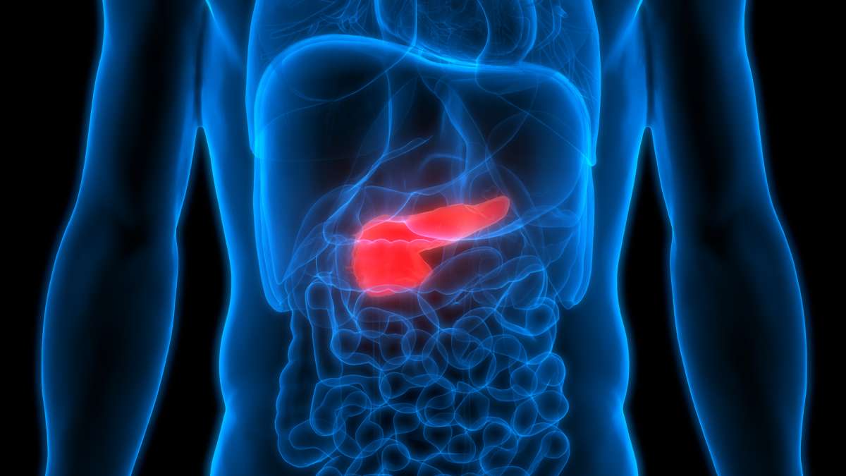 AI May Detect Earliest Signs of Pancreatic Cancer