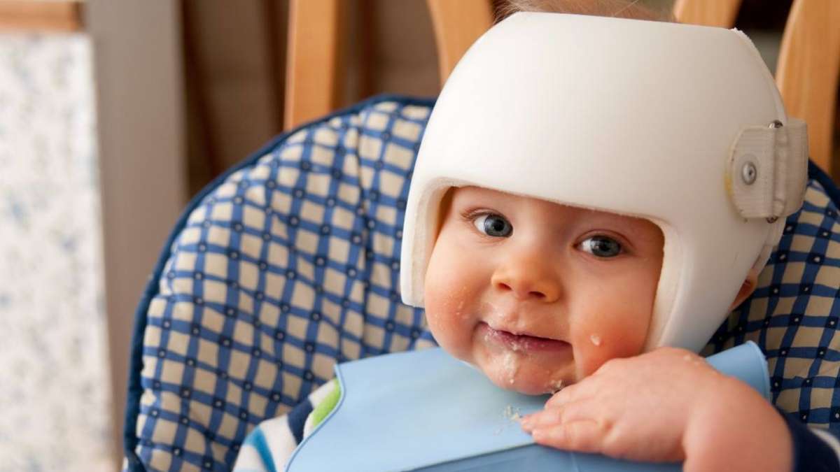 Baby getting flat head 2024 from sleeping on back