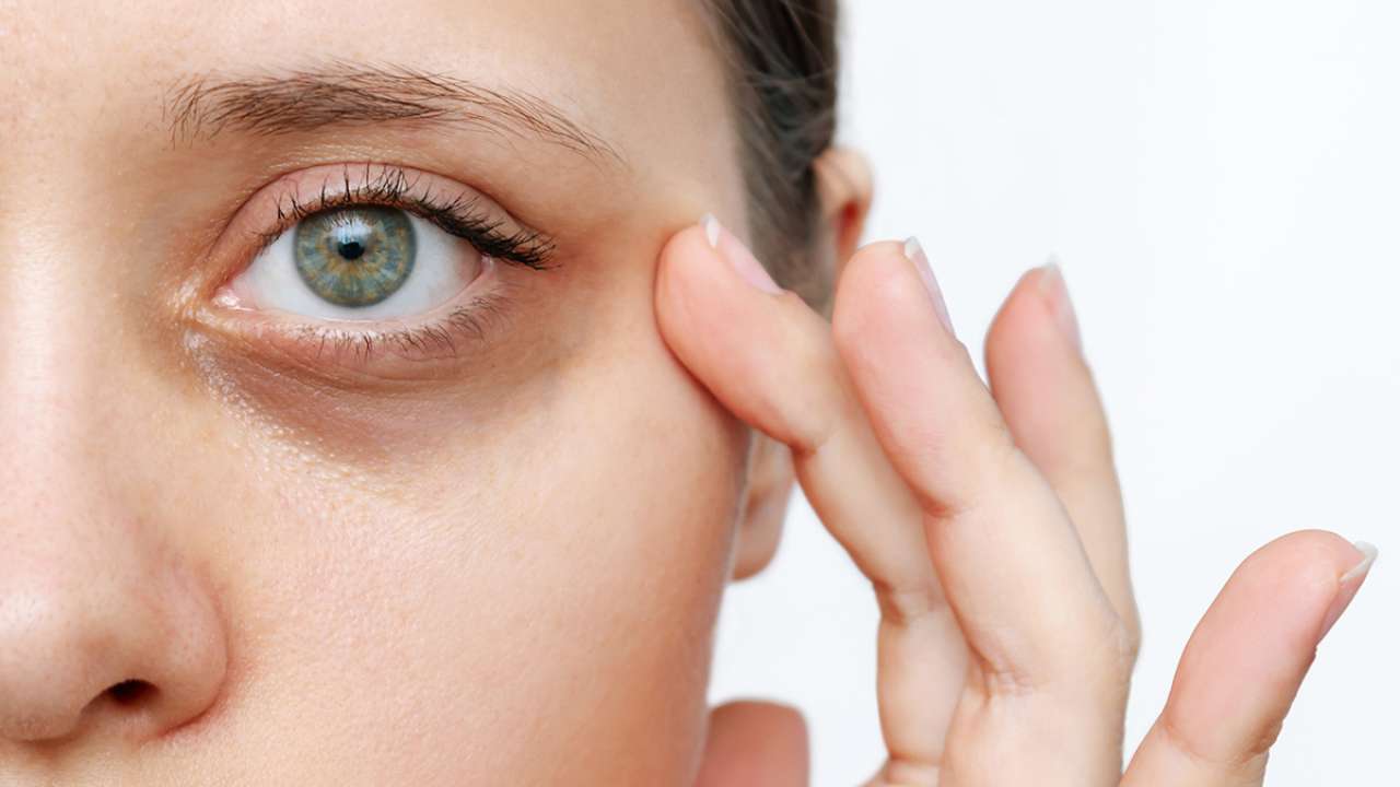 9 Causes of Dark Eye Circles - Take action to reduce dark circles under eyes  with natural, noninvasive methods - Blissoma Botanical Beauty