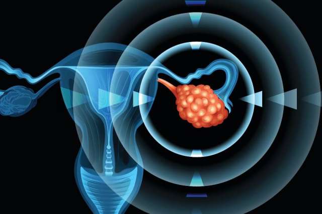 How is ovarian cancer detected?