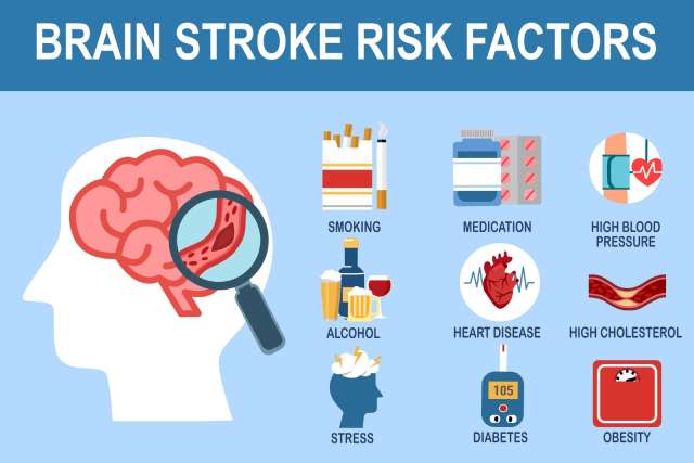 Risk Of Stroke Is Up Worldwide What Can Be Done About It UCLA Health   Stroke Graphic Istock 1345643700 