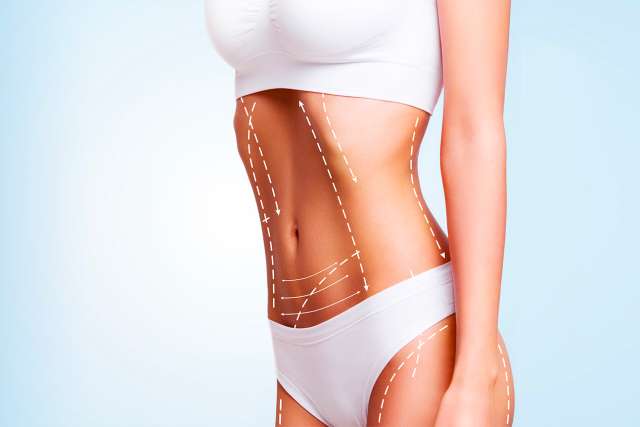 What to Expect From Your Breast Reduction Surgery: Advanced Plastic Surgery  Center: Plastic and Reconstructive Surgeons