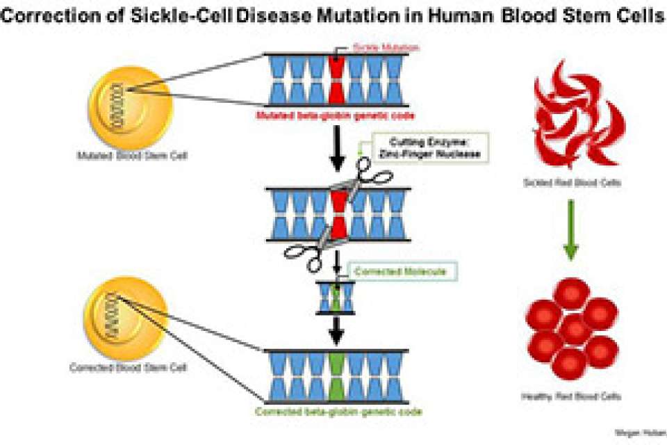 Ucla Stem Cell Researchers Develop Promising Method To Treat Sickle