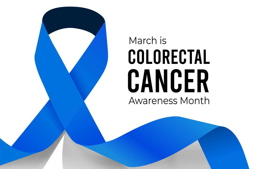 Colorectal cancer screening guidelines have changed to address rise in