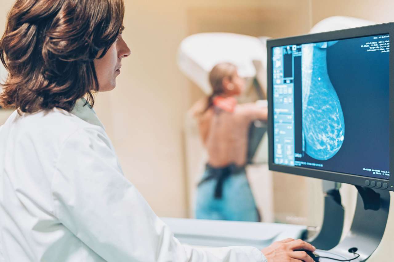 Doctor looking at a mammogram
