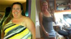 Julie's Gastric Sleeve Story, Success Stories