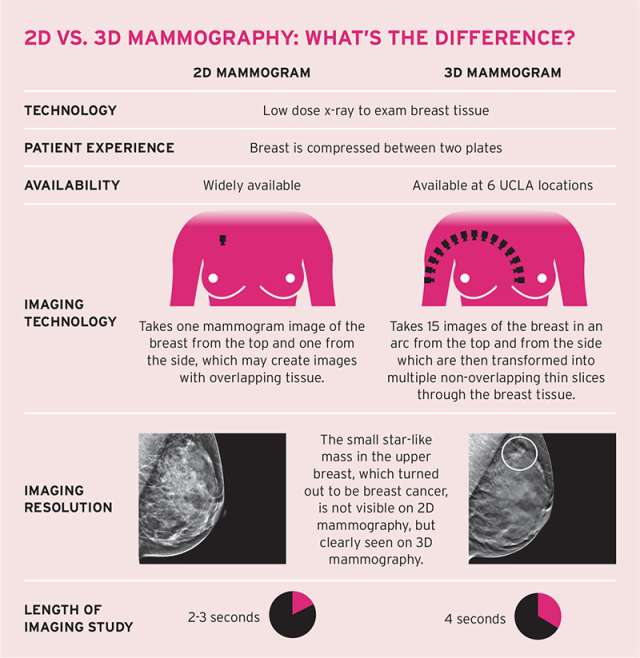 Breast Imaging 3D Mammography Tomosynthesis Breast Imaging UCLA   2Dvs3Dmammo 