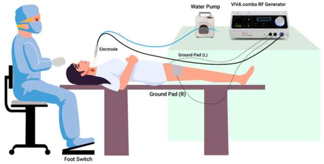 Thyroid Radiofrequency Ablation (RFA) - Endocrine Surgery | UCLA Health