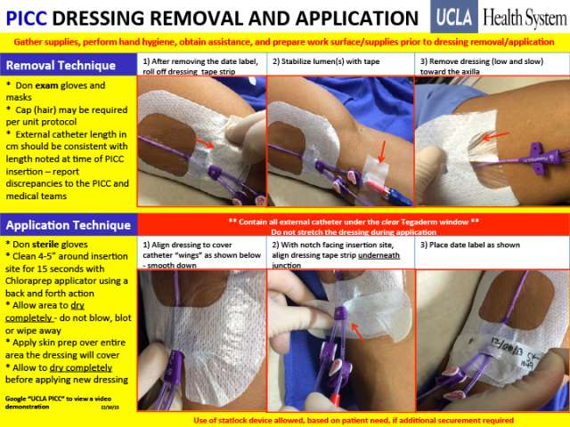 ClearFilm-IV - PICC Line Dressing, Midline Dressing | Richardson Healthcare